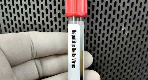 Epatite Delta, approvato negli Stati Uniti il primo trattamento specifico: perch� Hepcludex pu� cambiare la cura di una malattia rara e grave